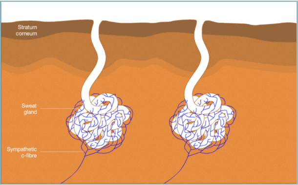 What does Sudoscan Measure?