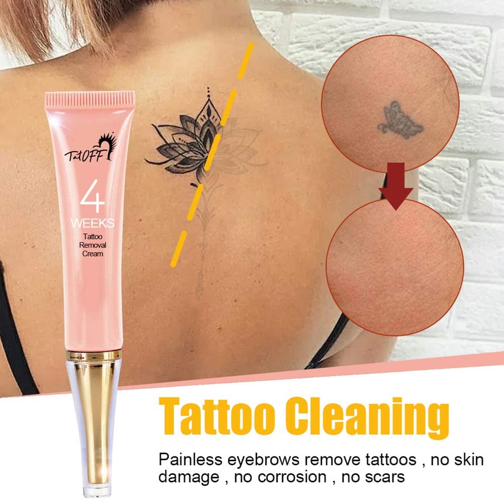 Laser Removal Is Fast But    Laser Ninja Tattoo Removal