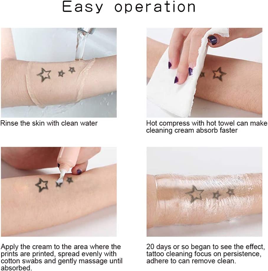 How Fast Is Laser Tattoo Removal