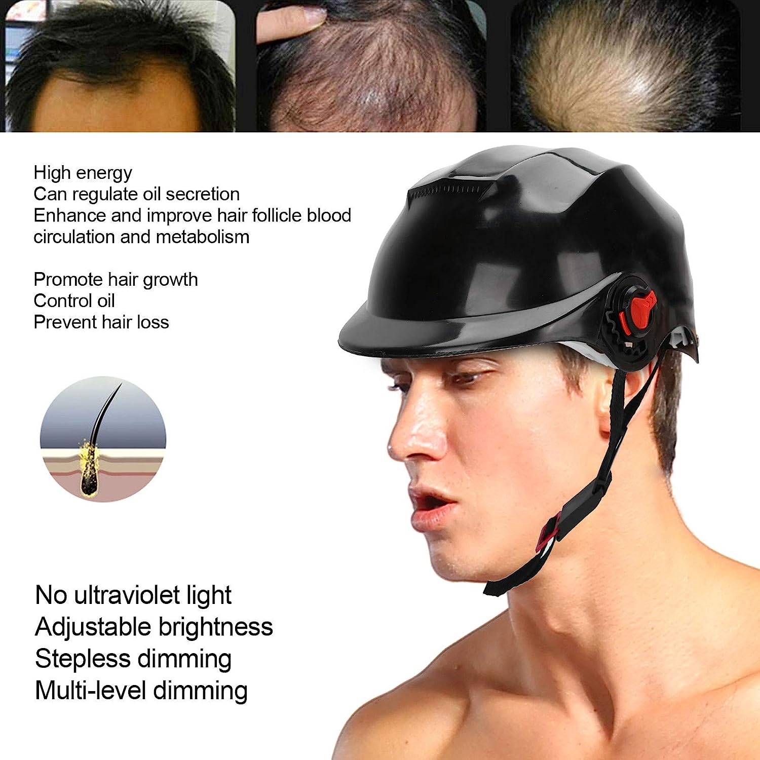 iGrow Laser Hair Growth Helmet Restoration  Regrowth Treatment System for Hair  Loss  Natural Thinning Balding