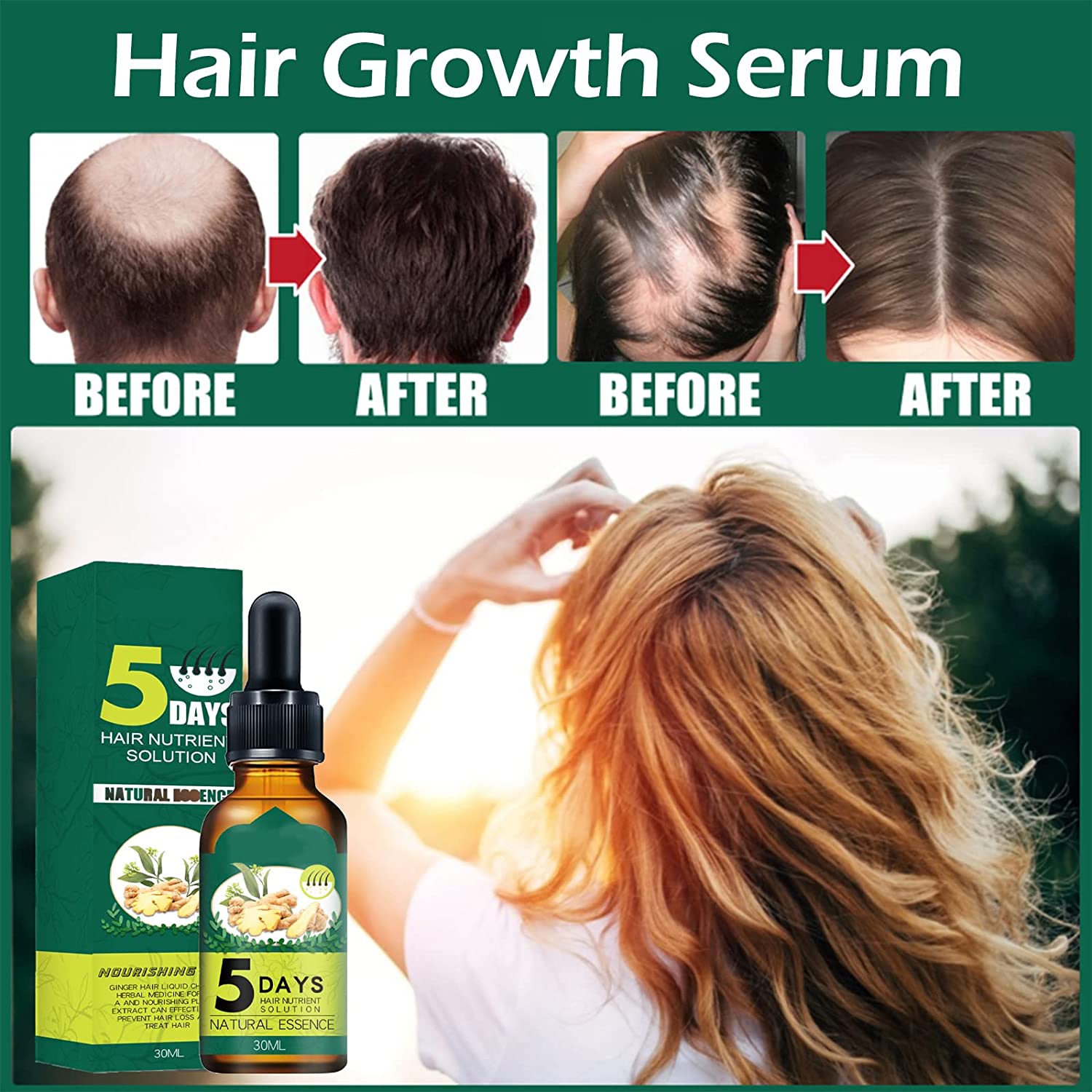 Chébé Butter EXTREME HAIR GROWTH 100 Pure  Natural Vitamin E  Etsy  Hair  growth faster Hair growth treatment Natural hair growth oil
