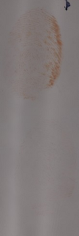 Figure 6. Running of LCV (sprayed while in an upright position) on a heavier blood print after rinsing with  water.