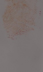 Figure 2. Running of LCV dye (sprayed in a flat position) on a heavier blood print after rinsing with water. 