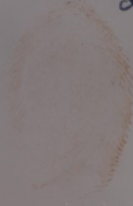 Figure 4. Enhancement of faint blood print with LCV (sprayed while in an upright position).
