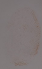 Figure 5. Bleeding of LCV on a heavier blood print after spraying with LCV in an upright position. 