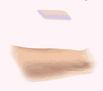 Patch Application