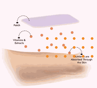 Patch Absorption