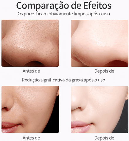 Aparelho de Peeling Ultra Sônico Portátil