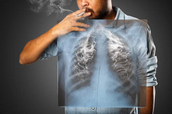 Smoking leads to complications in the lungs.