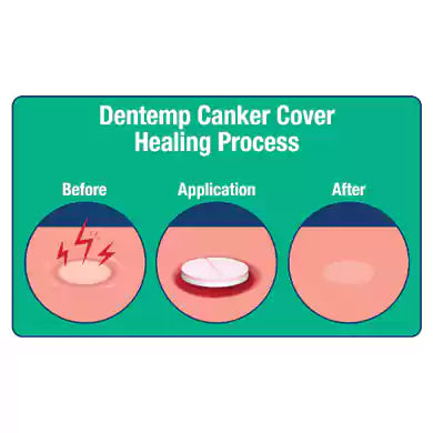 Canker Cover