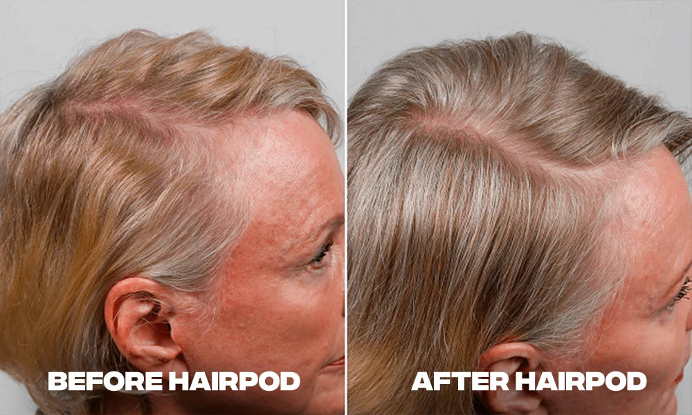 before-after-hair-thinning-woman.webp__PID:07450ce3-3c77-4b07-b703-db91a6478847