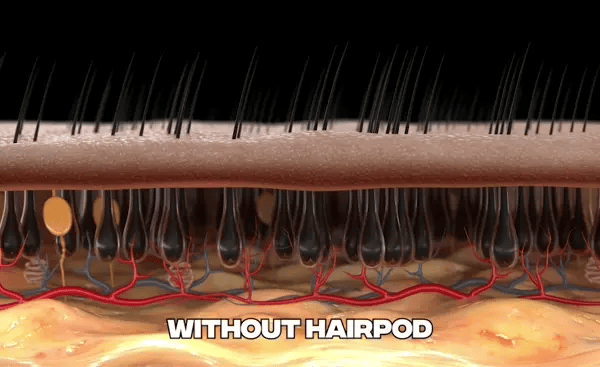 manual hair oiling HairPod 3d animation poor absorption.webp__PID:e6d6e9cc-e2d9-47af-bc2c-b7410db2f7ba