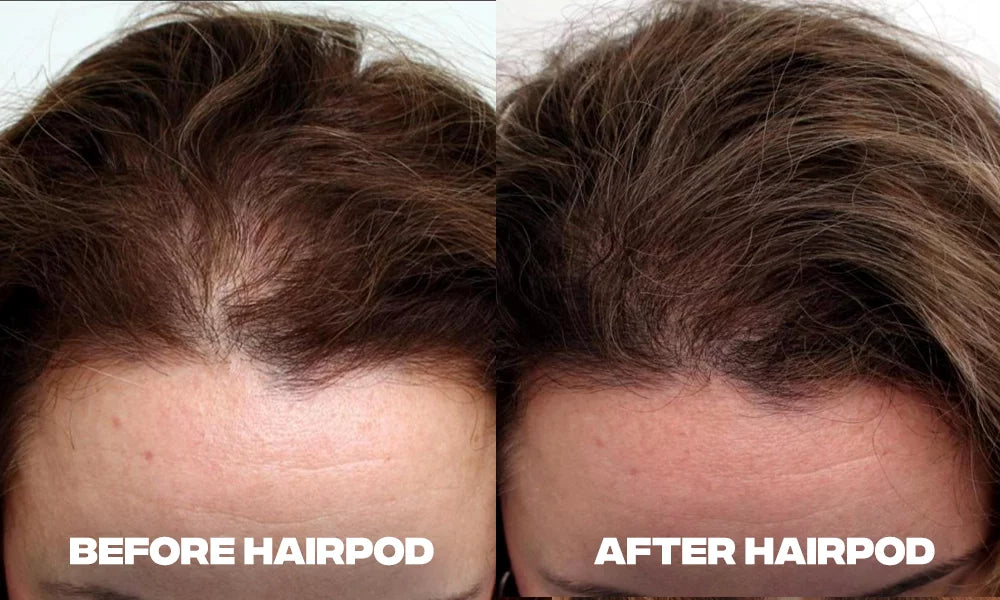 Before and After Results of Hair Fullness with HairPod Use