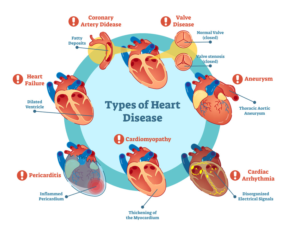 The Different Types of Heart Diseases