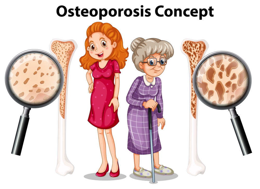 Osteoporosis