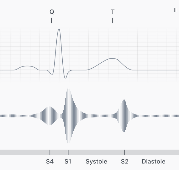 S4 audio + ECG
