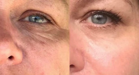 I absolutely love the EyeCare Pro! It really is a fantastic skincare device... I came across it in an advert and was quite skeptical at first, but I'm glad I took the plunge. It is now an integral part of my evening routine and the difference is clearly visible!
