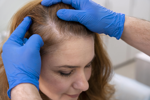 scalp health for stronger hair