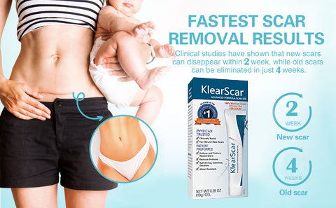 KlearScar™ Advanced scar removal gel