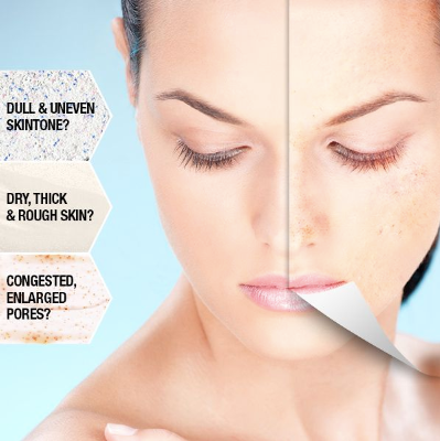 skin congestion types