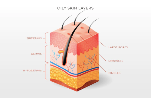 Oily Skin layers