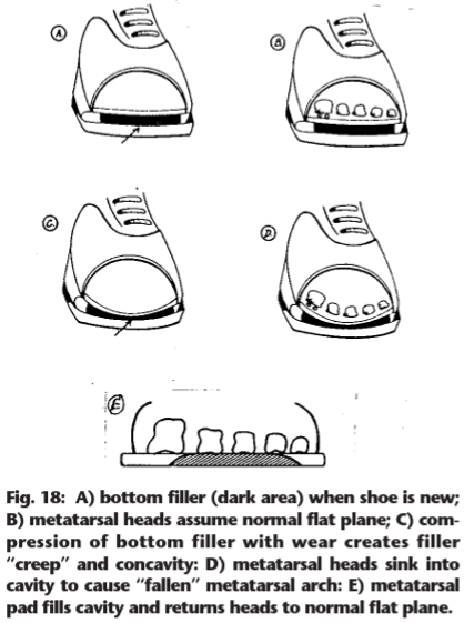 Concave Lasts and Midsoles Cause forefoot pain