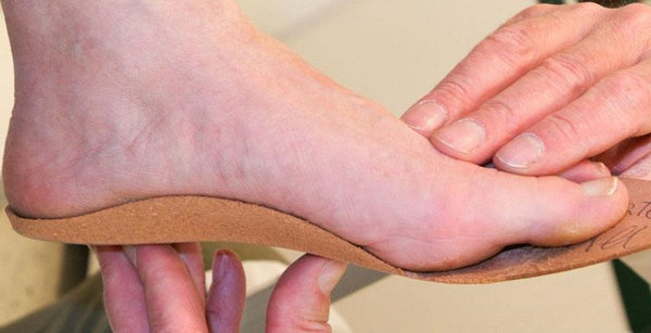 orthotics for fallen arches