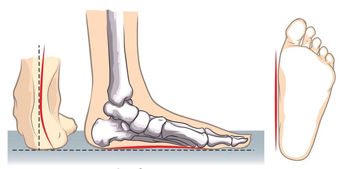 medical foot insoles
