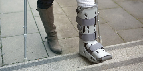 Foot Stress Fractures Causes, Symptoms 