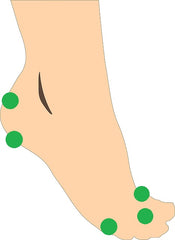 bursitis foot pads