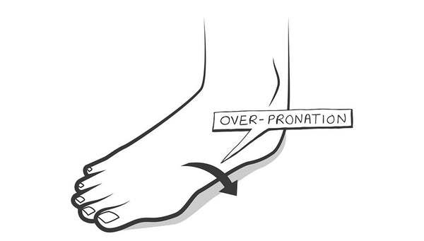 Over-pronation area on foot