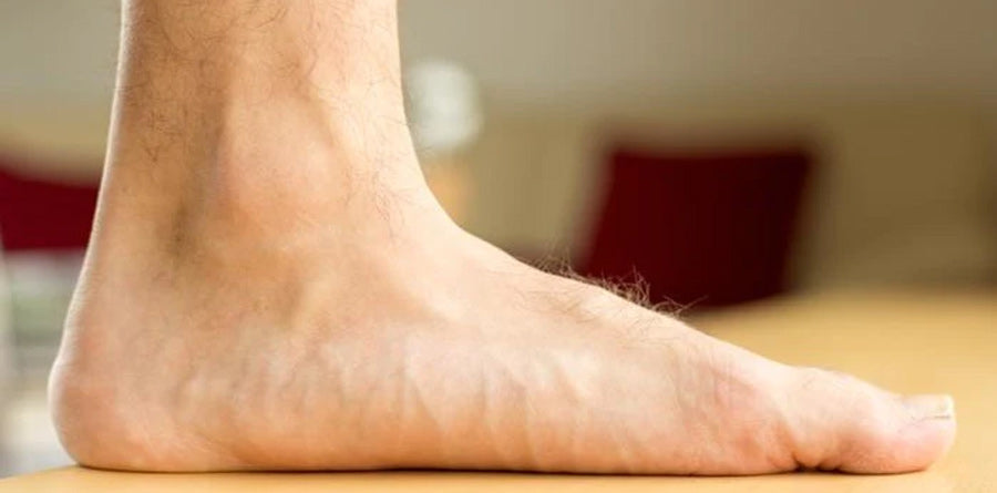Manage Foot Conditions With Orthopedic Sandals: 6 Common Ailments - Tread  Labs