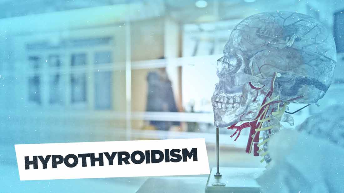 hypothyroidism