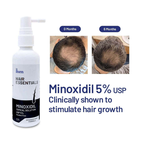 ForMen Minoxidil Topical Solution