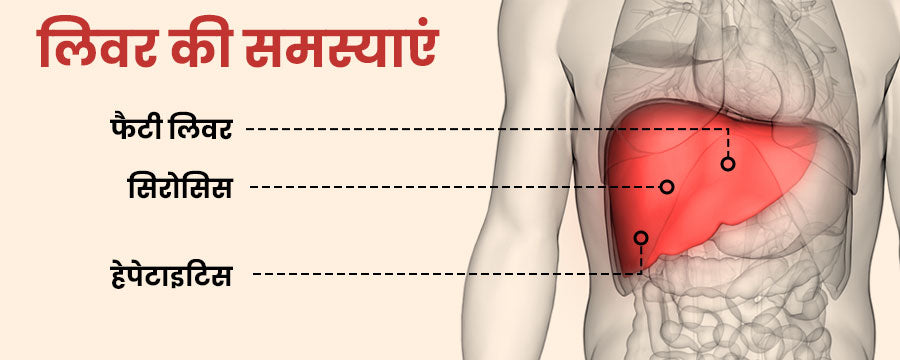 लिवर की समस्याएं