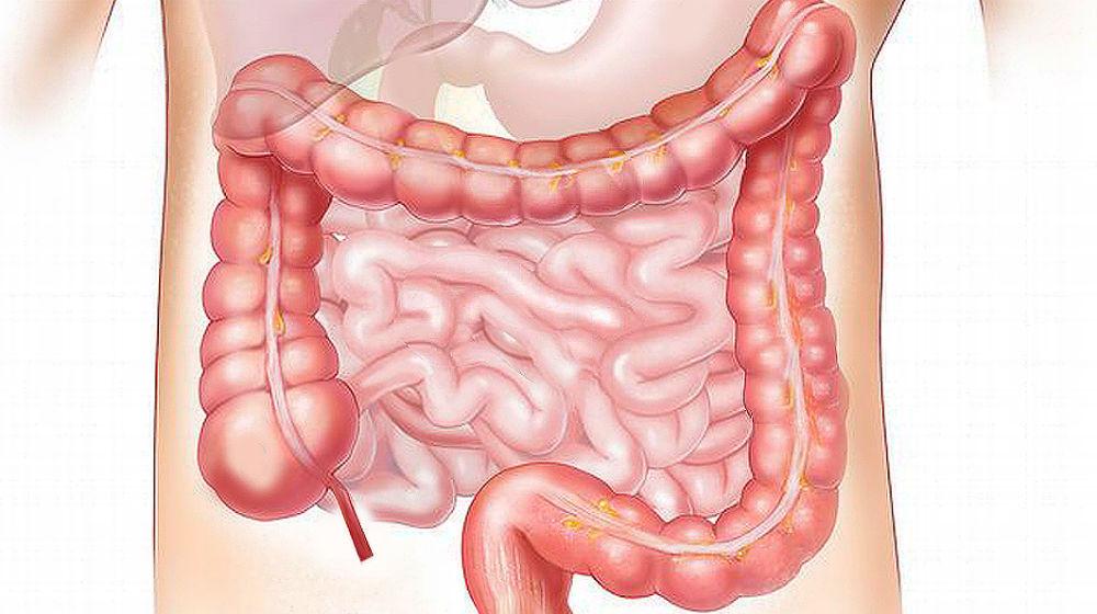 overgrowth of bacteria in gut