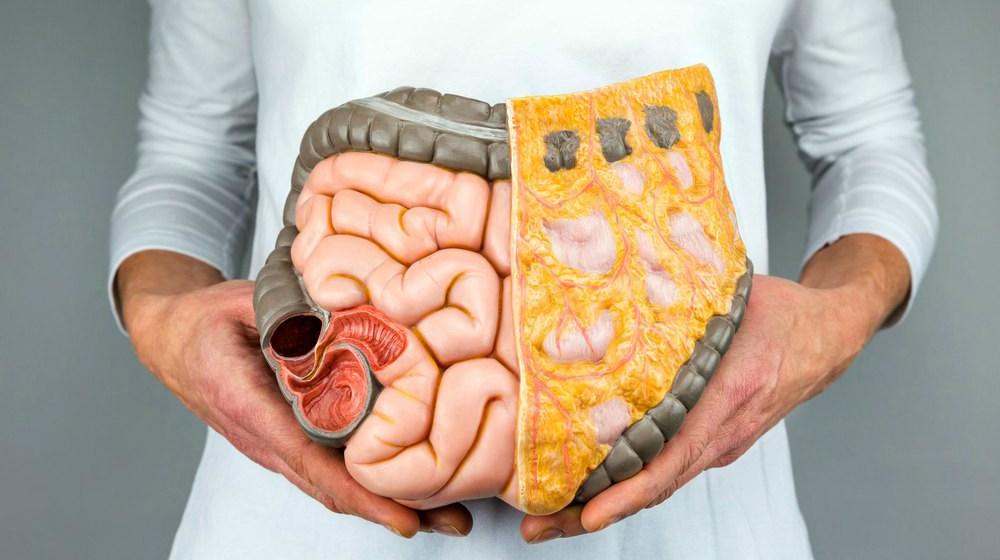 What Is Small Intestinal Bacterial Overgrowth All You Need To Know
