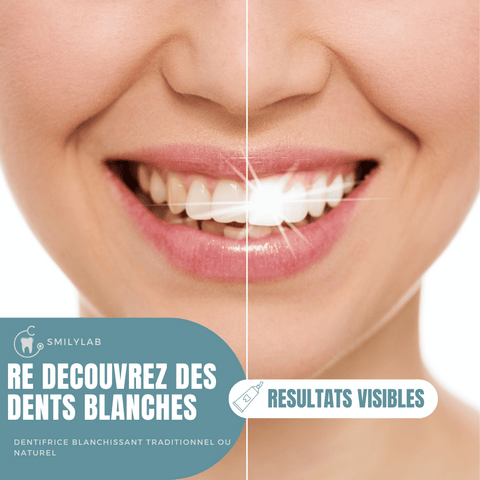 Des résultats visibles avec nos dentifrices blanchissants