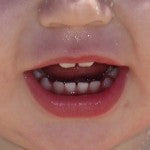 Baby Zähne