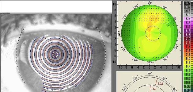 Topographie