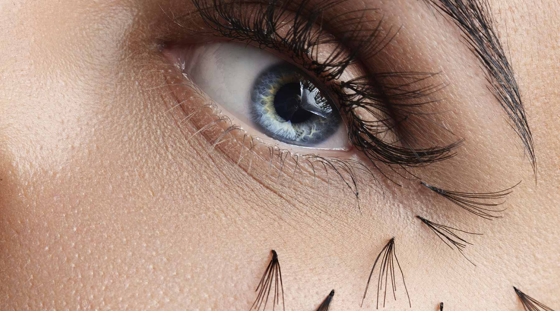 lash shedding caused by the use of an inappropriate lash glue, highlighting the importance of choosing the right adhesive for lash extensions to prevent damage and ensure longevity