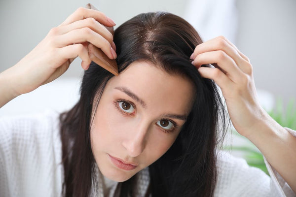 what causes dandruff in your hair
