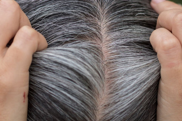 what causes premature hair graying