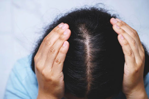 what causes itchy scalp and hair loss?