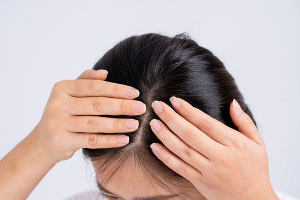 how to keep your scalp moisturized