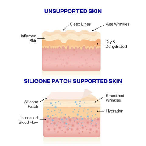 WrinkleEase™ Anti Wrinkle Silicone Face and Body Patches