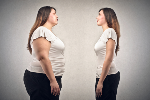 Long-Term Lifestyle Changes After gastric sleeve