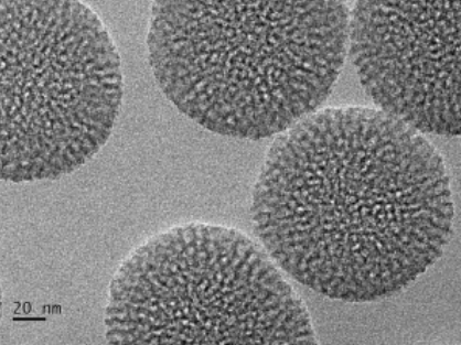 TEM image of Solid-Core Mesoporous Silica Nanoparticles