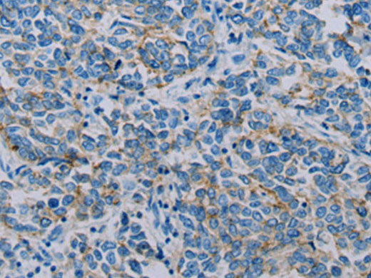 Claudin 4 Polyclonal Antibody Store at -20°C - Image 3