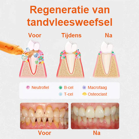 Unpree™ Tandvleesherstelbehandeling Ampullen